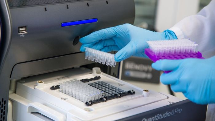 В СамГМУ разработали тест-систему для диагностики внутрибольничных инфекций