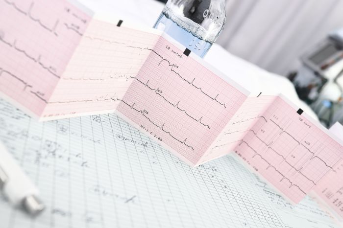 Разработан алгоритм для диагностики сердечно-сосудистых заболеваний за несколько секунд